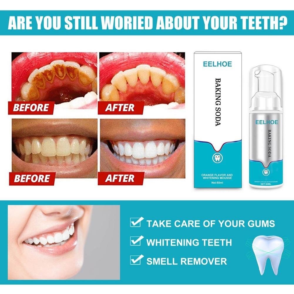 Black Friday Sale - 49% OFF - Instant Tooth Whitener