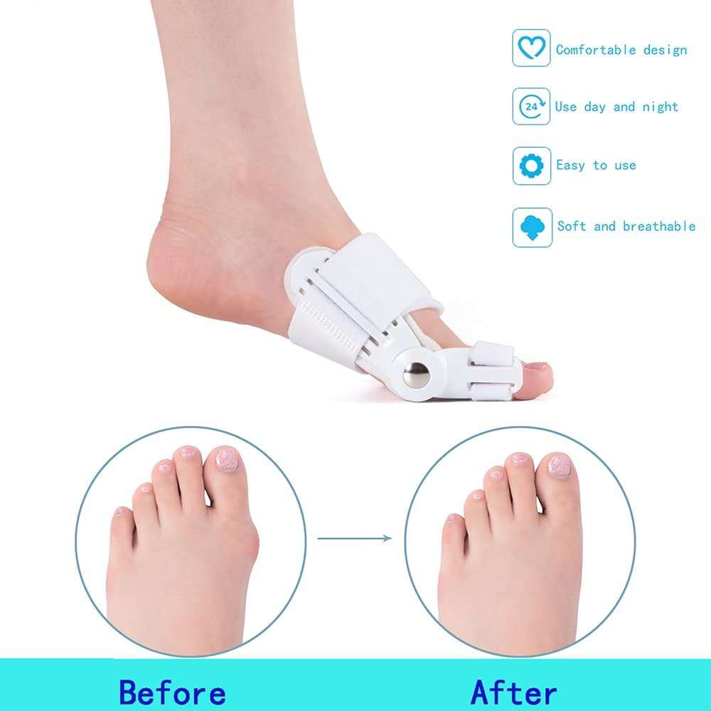 Dayweeks BUNION CORRECTOR FOR MEN & WOMEN