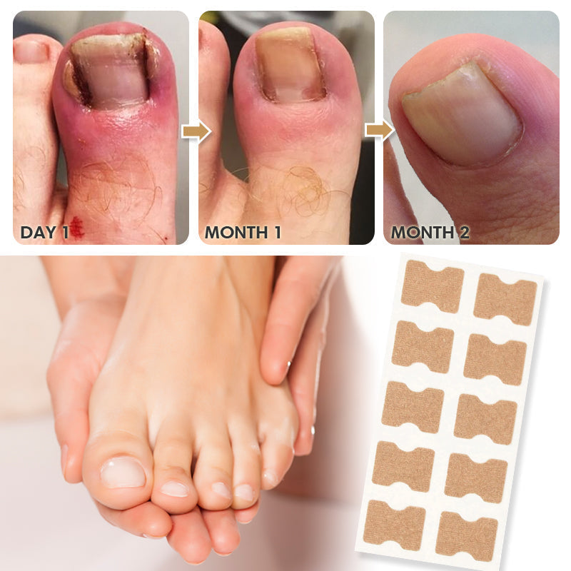 Fertoe Toenail Corrector Patch