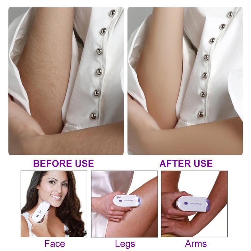 Glow Up - Painless Epilator