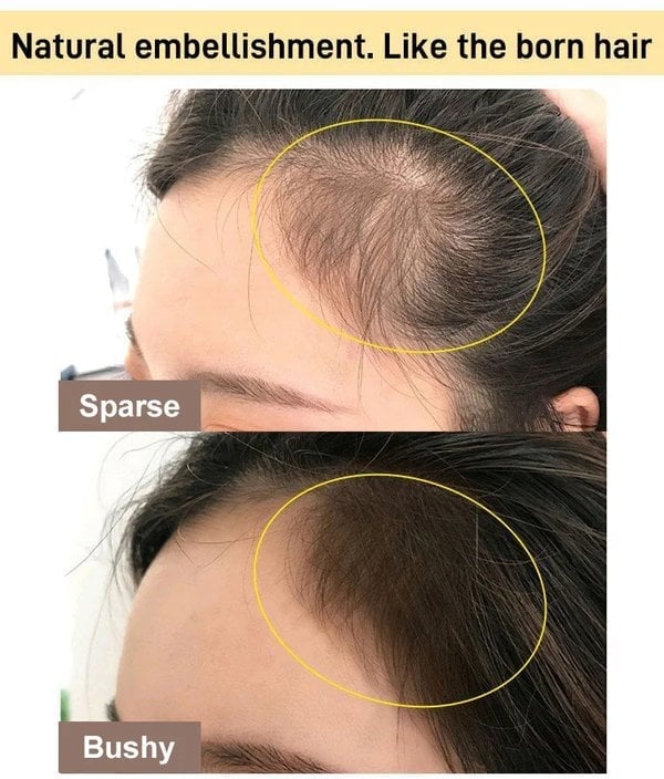 Hairline Contouring