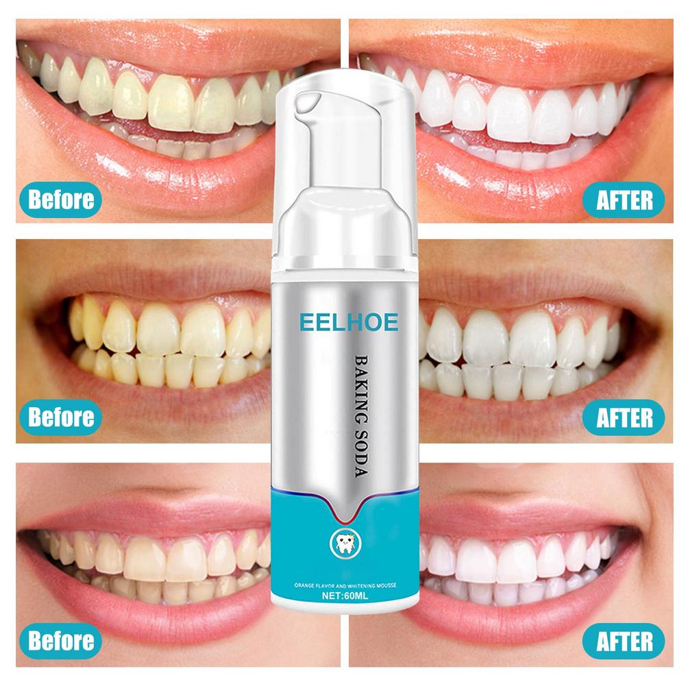 Hot Sale - 49% OFF - Instant Tooth Whitener