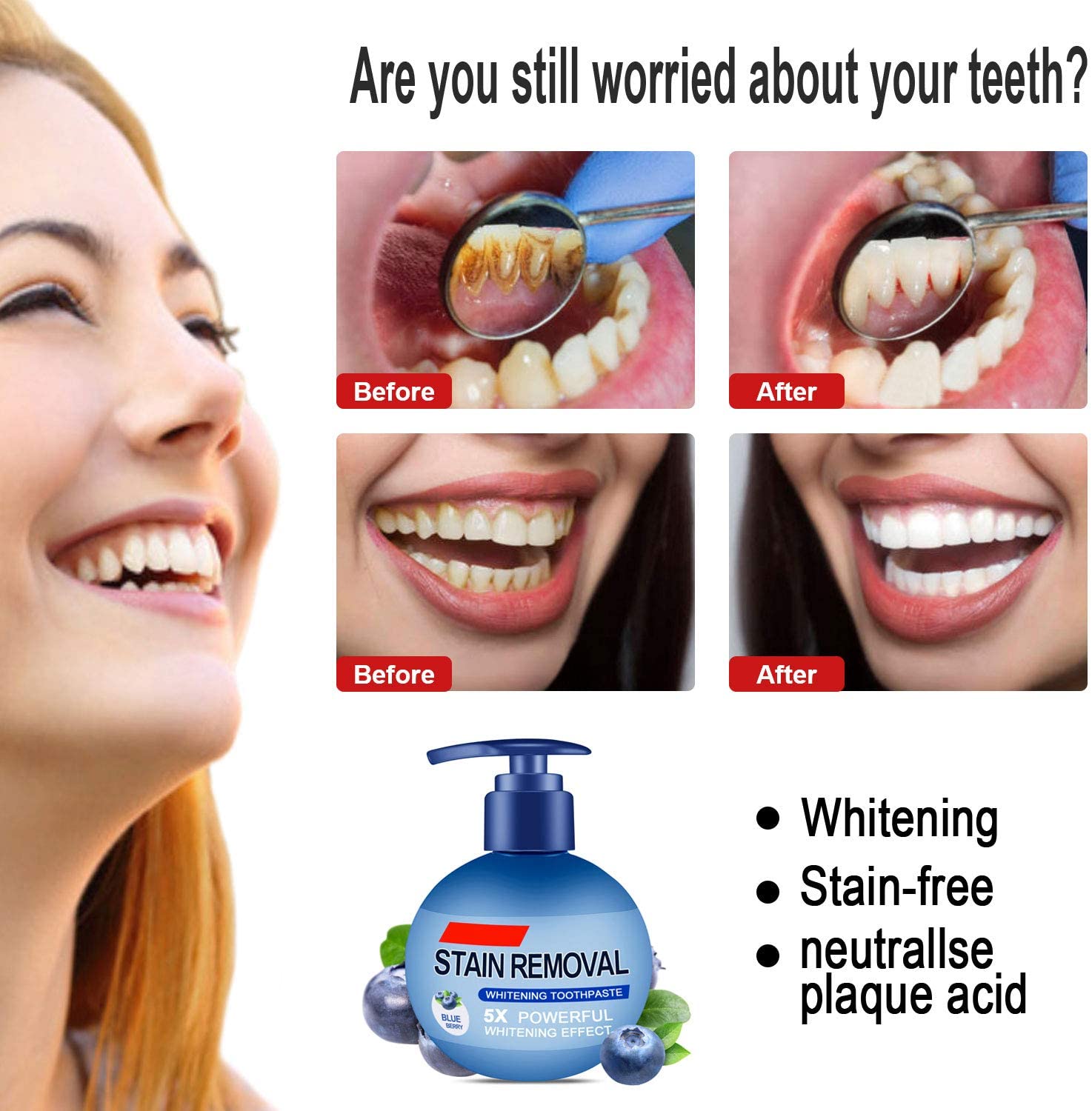 Intensive Stain Removal Whitening Toothpaste