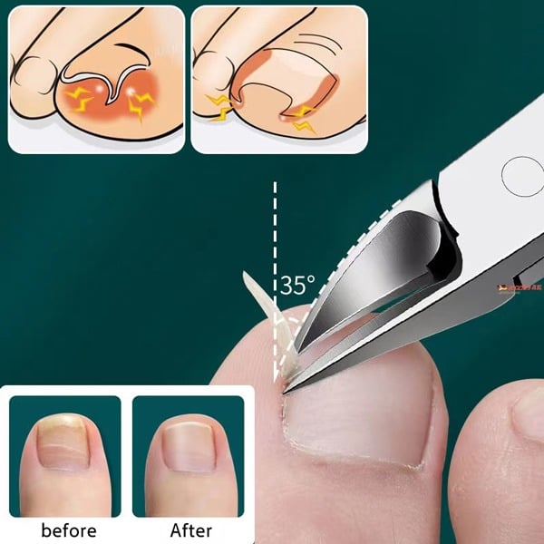 Last Day 50% OFF – Professional Nail Clipper