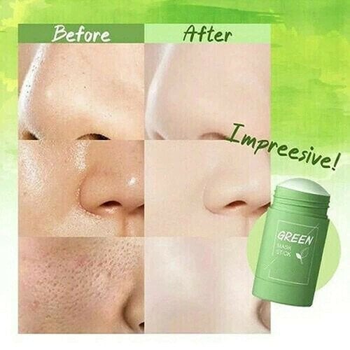 Last Day Promotion 70% OFF - Non Porous Deep Cleansing Mask Pen