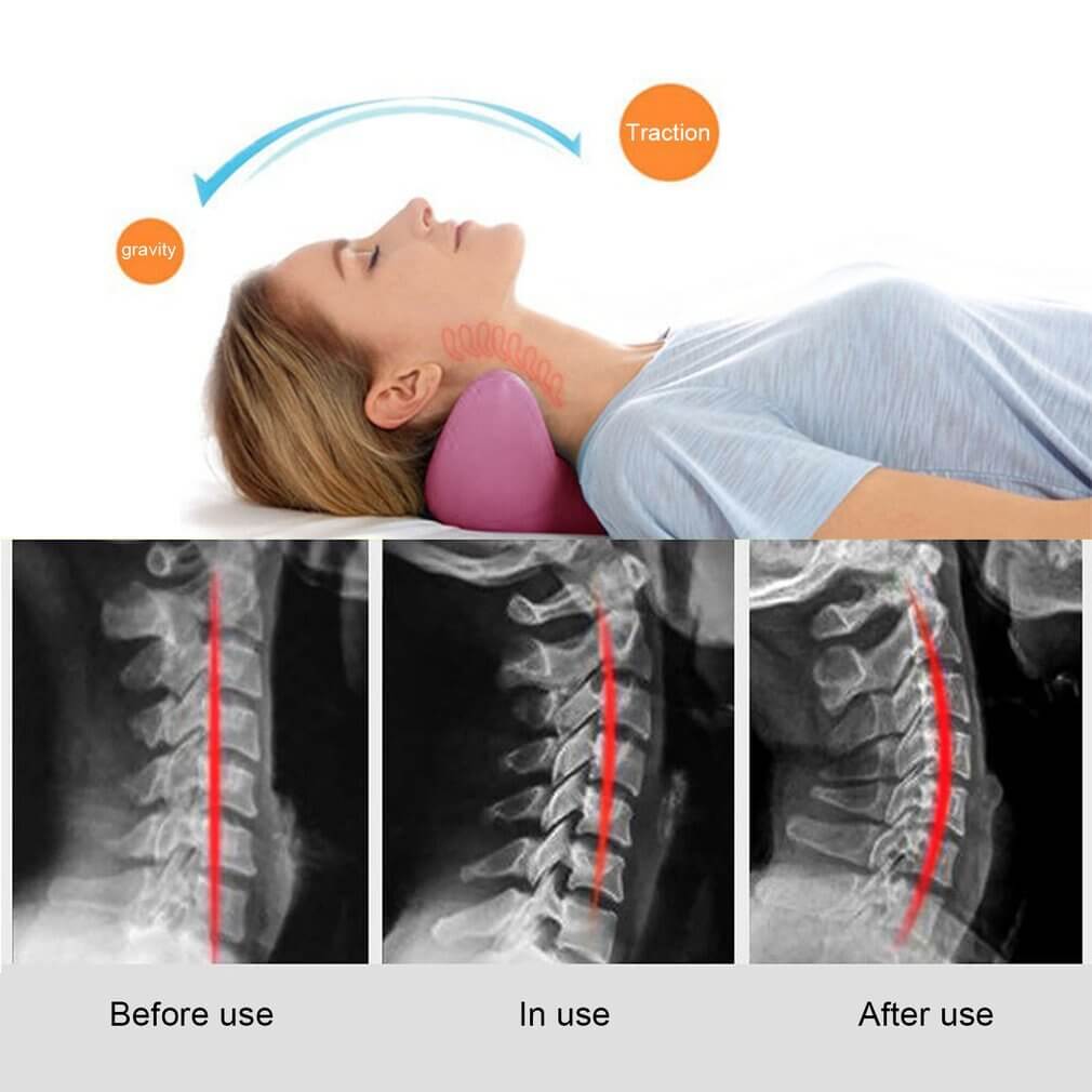 Neck Cloud - Cervical Traction Device