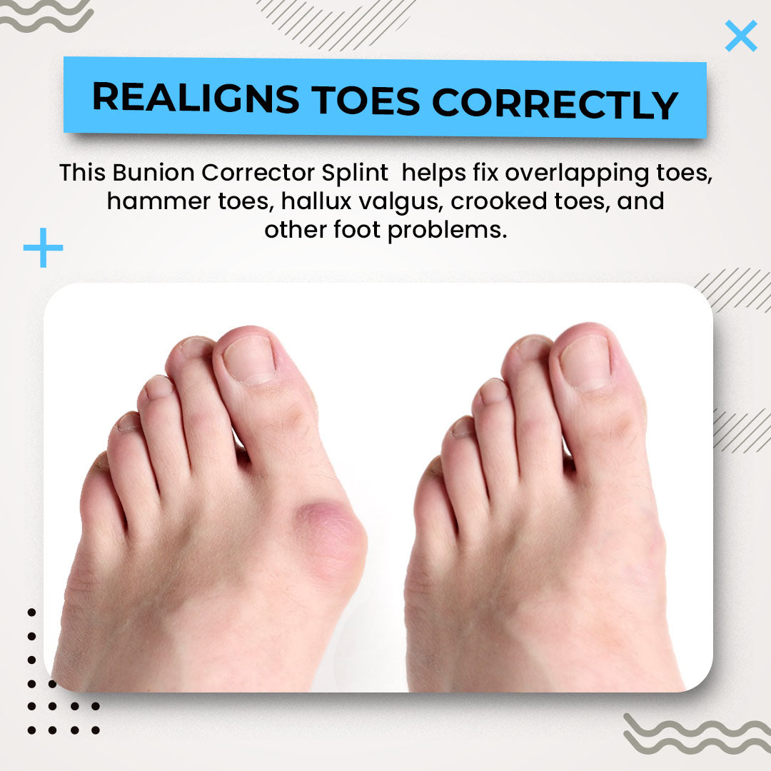 Alayna 3D Instant Bunion Splint