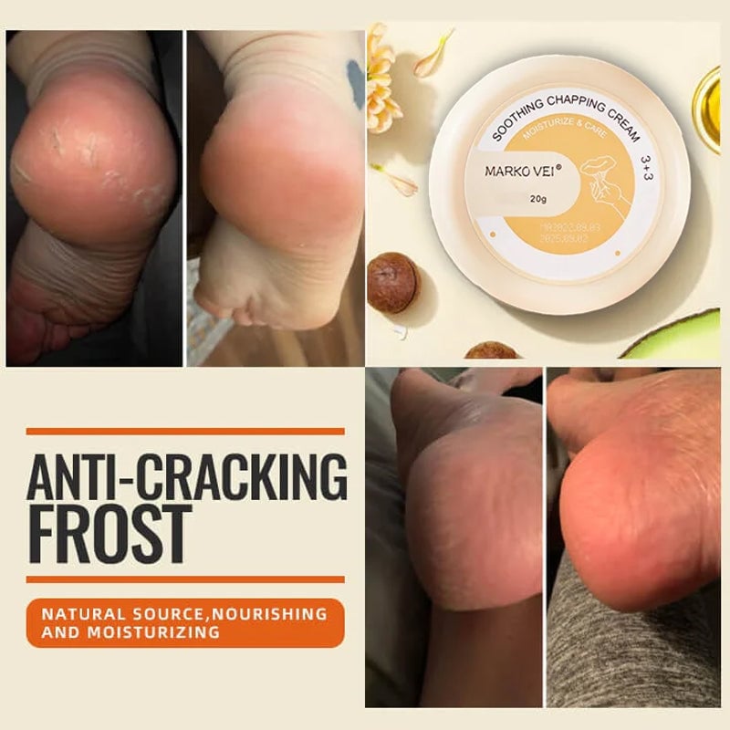 SALE-50% OFF Anti-Cracking Frost