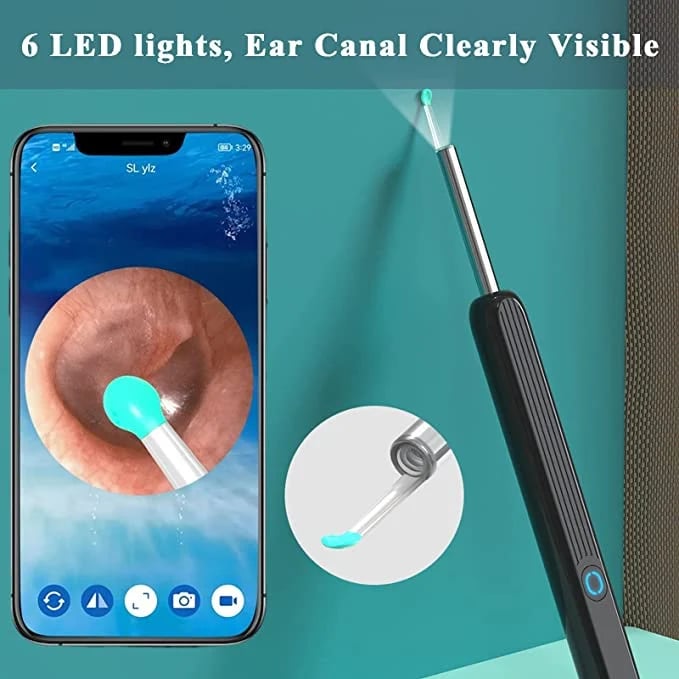 Wi-Fi visible wax elimination spoon, USB HD load otoscope