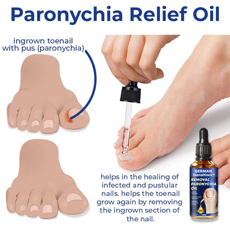 German ToenailCare Removal Paronychia Oil