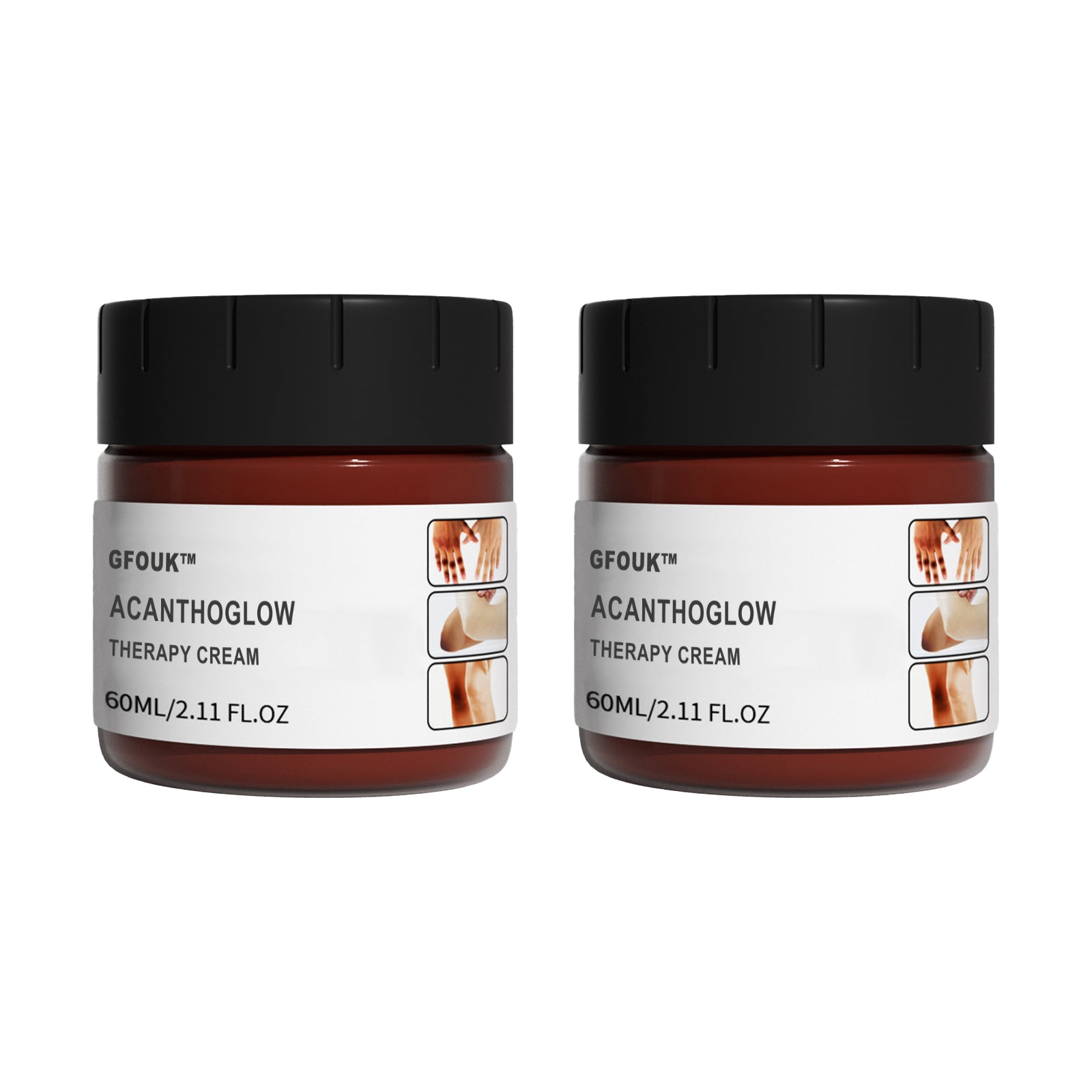 GFOUK AcanthoGlow Therapy Cream