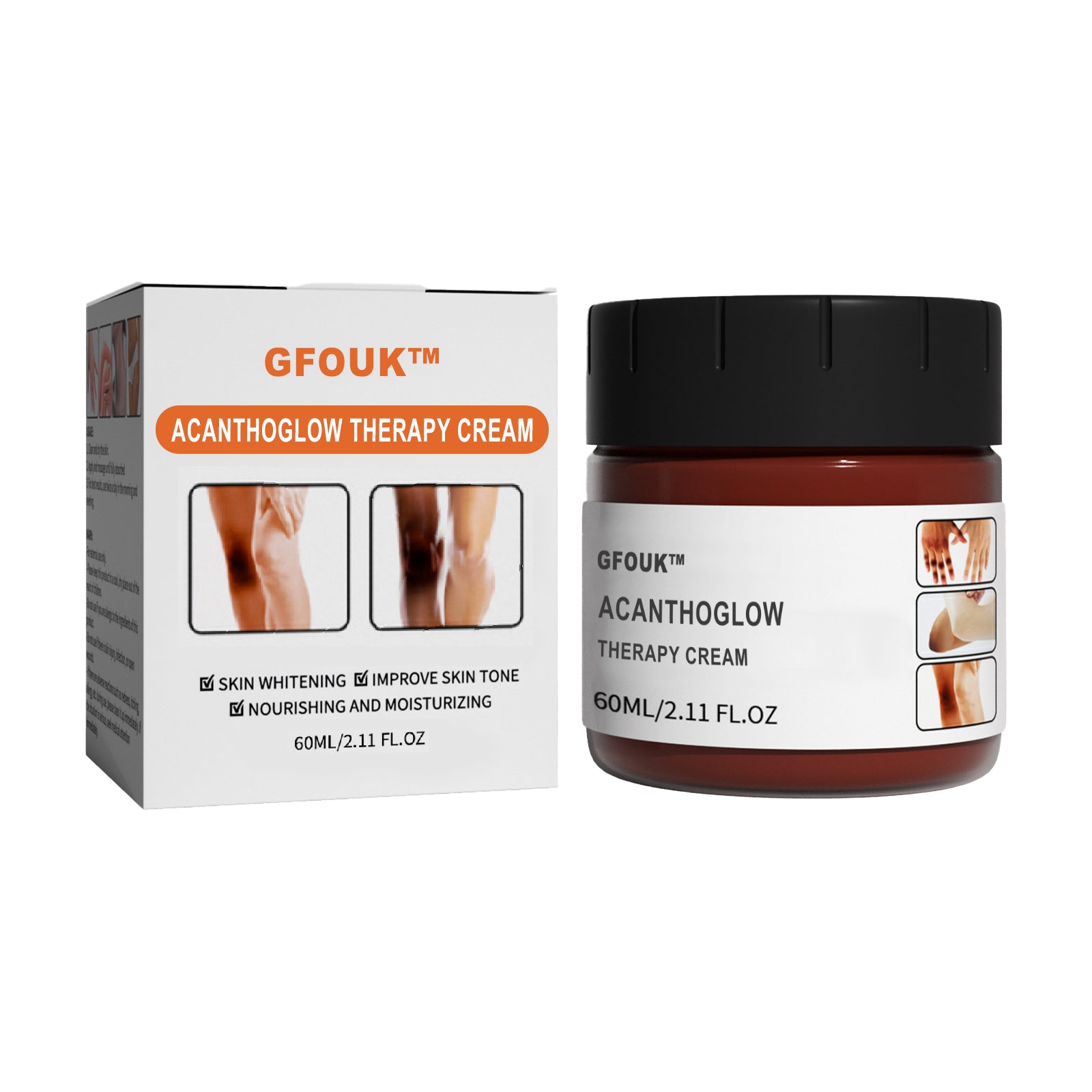 GFOUK AcanthoGlow Therapy Cream