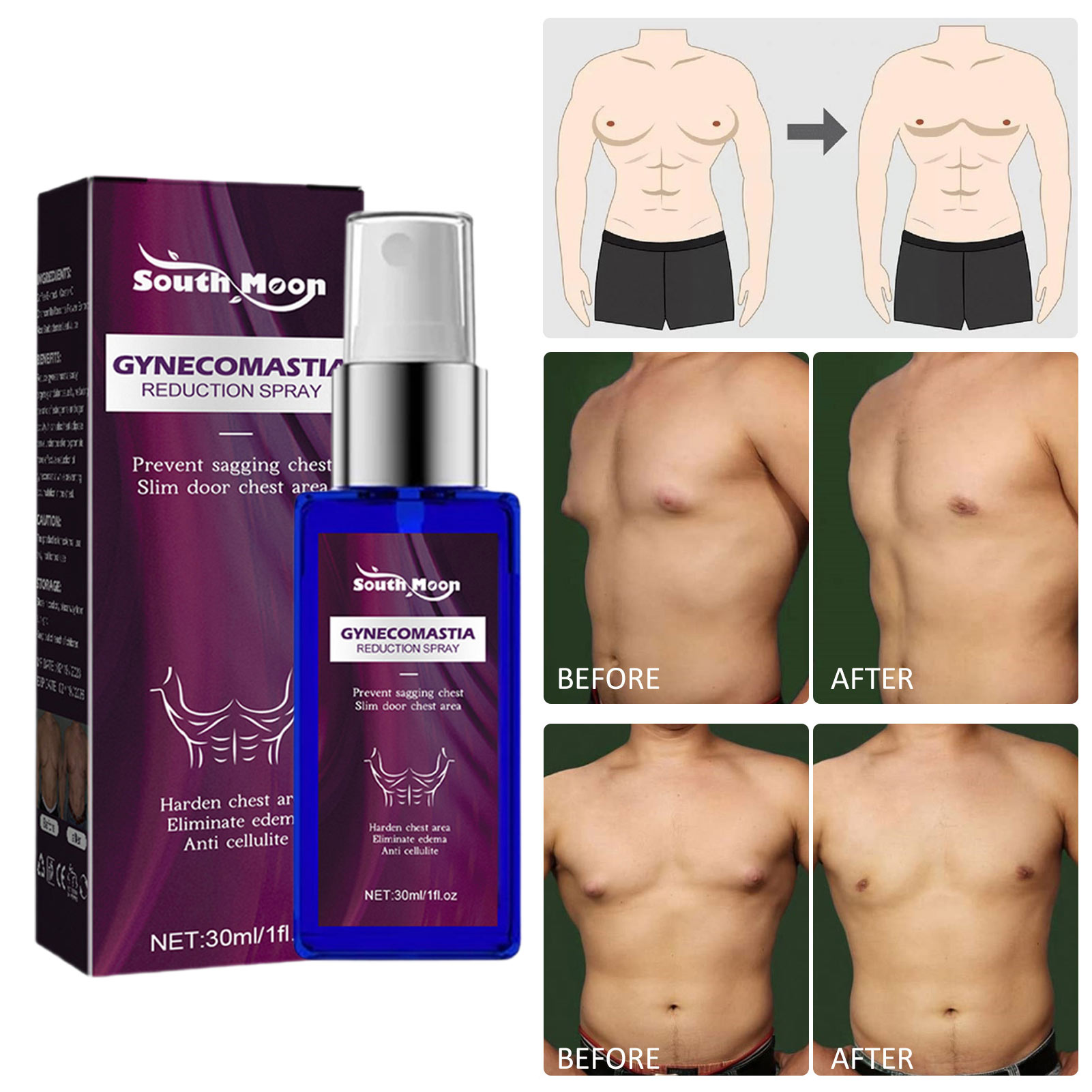 Gynecomastia-Reduction Spray