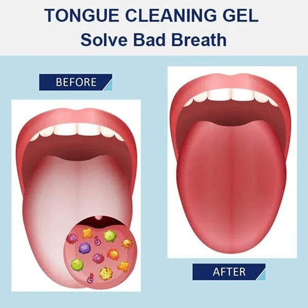 HOT SALE 60% OFF - Probiotic Tongue Cleaning Gel Set