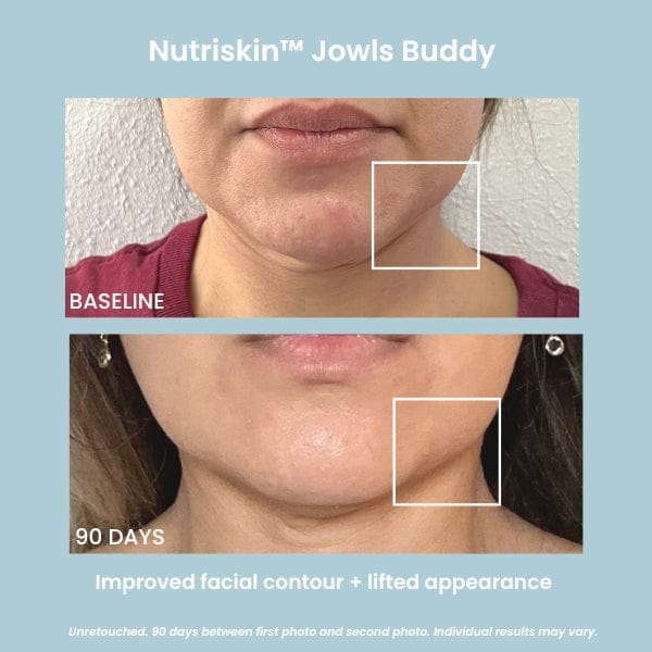 Jowls Buddy: Microcurrent Facial Toning & Skin-Tightening Device