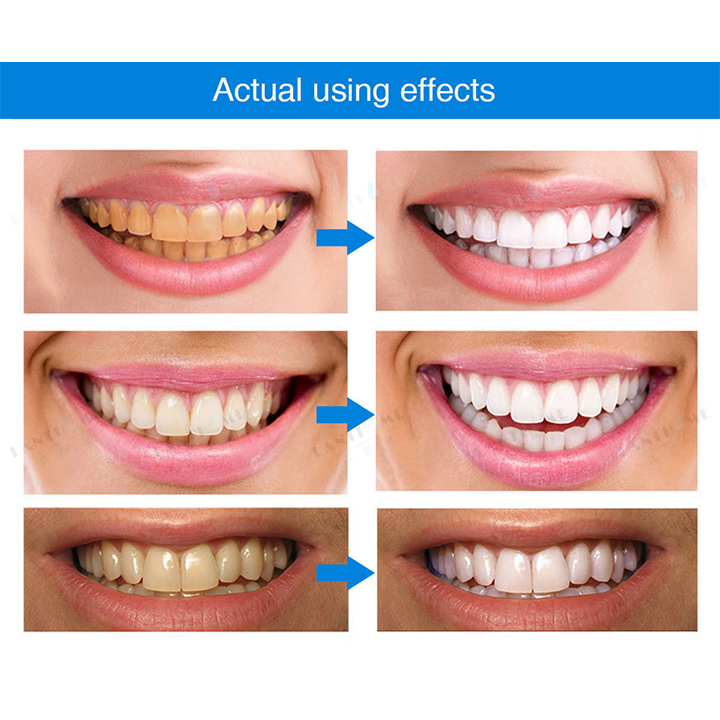 Lanthome Teeth Whitening Essence