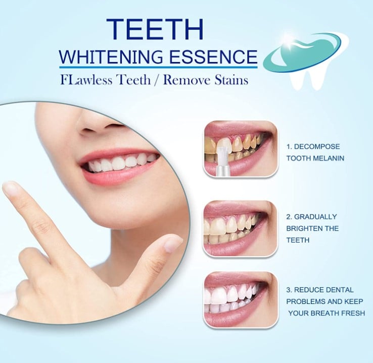 Last Day Promotion 50% OFF - Teeth Whitening Essence