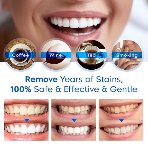 Last Day Promotion 50% OFF - Teeth Whitening Essence