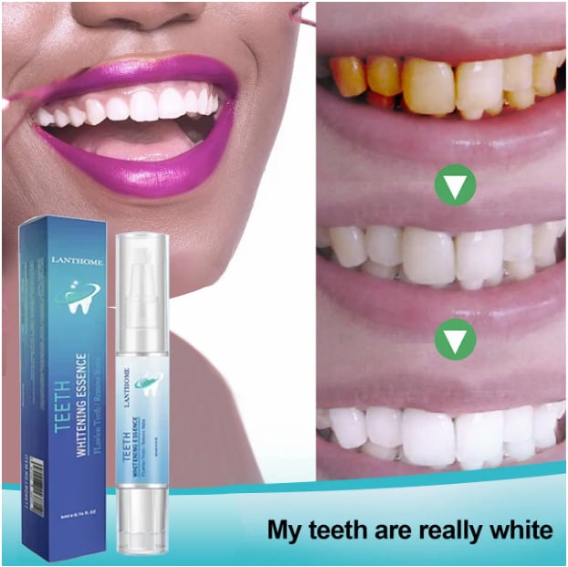 Last Day Promotion 50% OFF - Teeth Whitening Essence