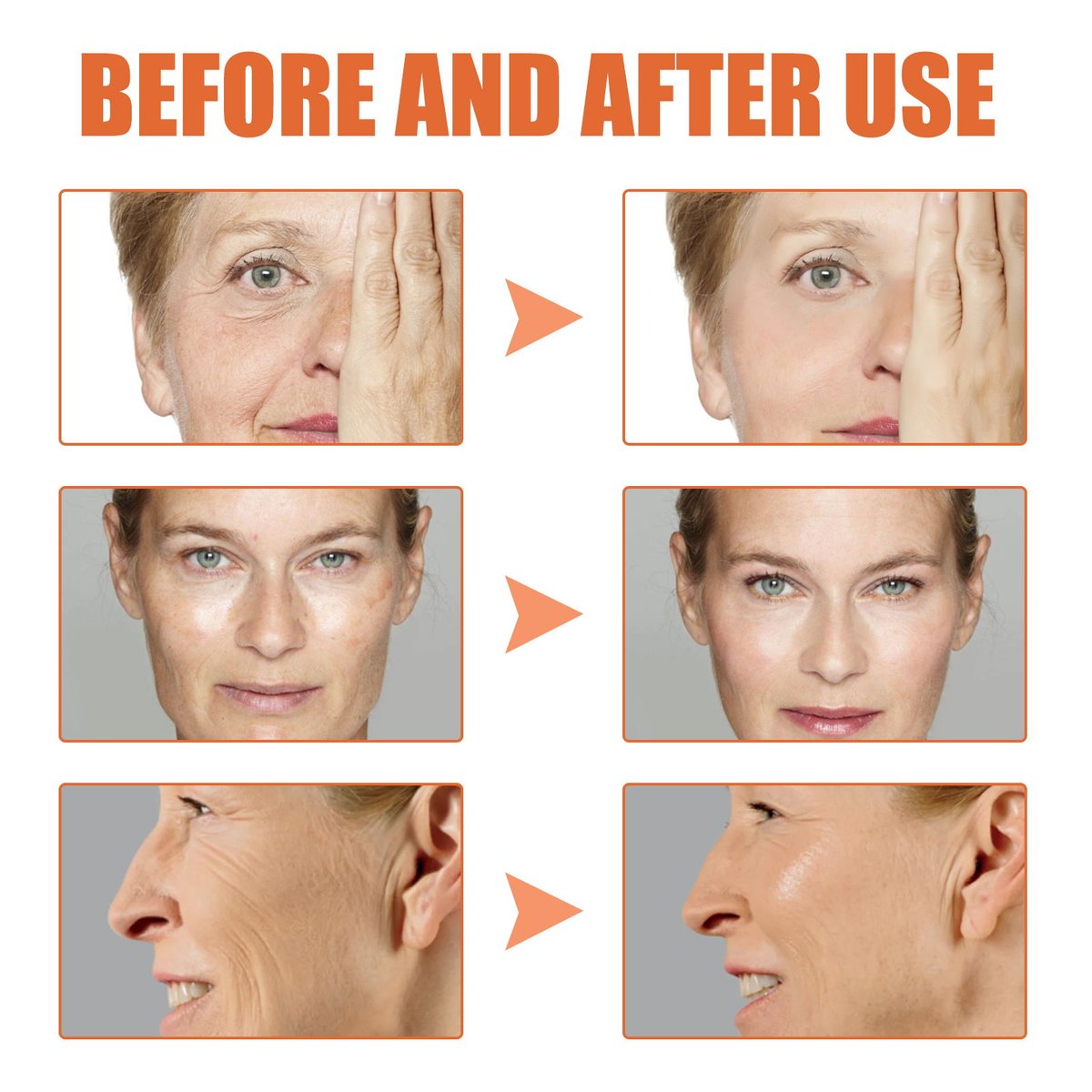 LAST SALE – 49% OFF Botox Face Serum