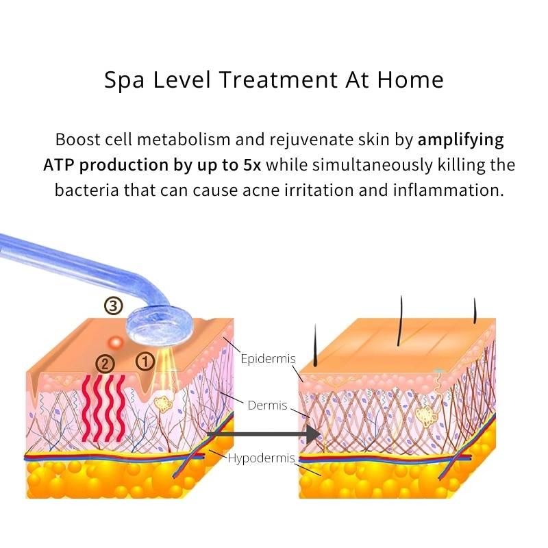 Primalderm High Frequency Therapy