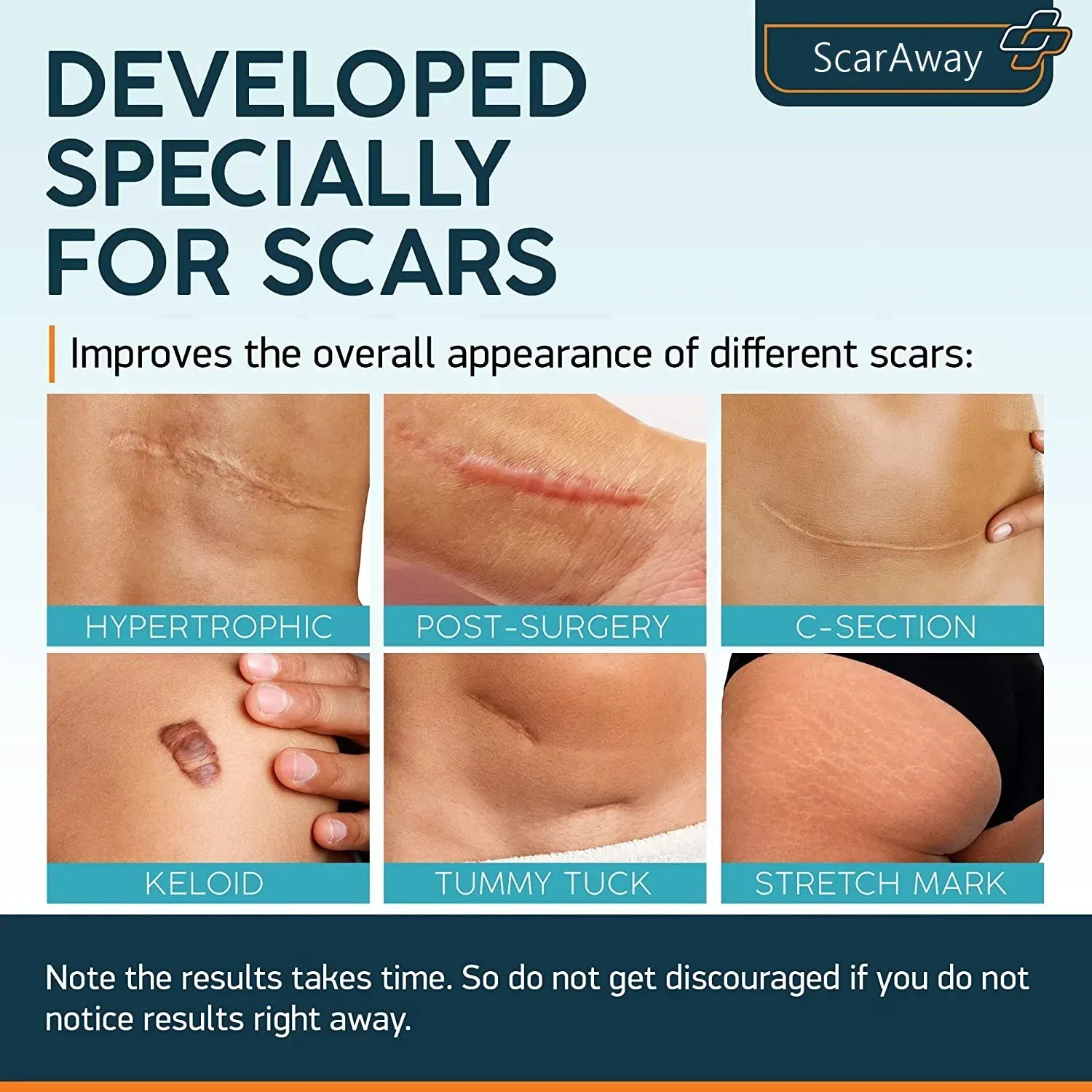 ScarAway Advanced Scar Gel