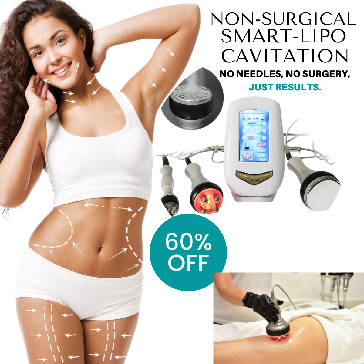 SculptSkinny Smart-Lipo Cavitation Body Contouring & Skin Tightening