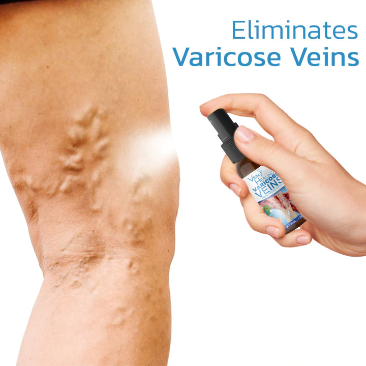 Veinhealing Varicose Veins Treatment Spray