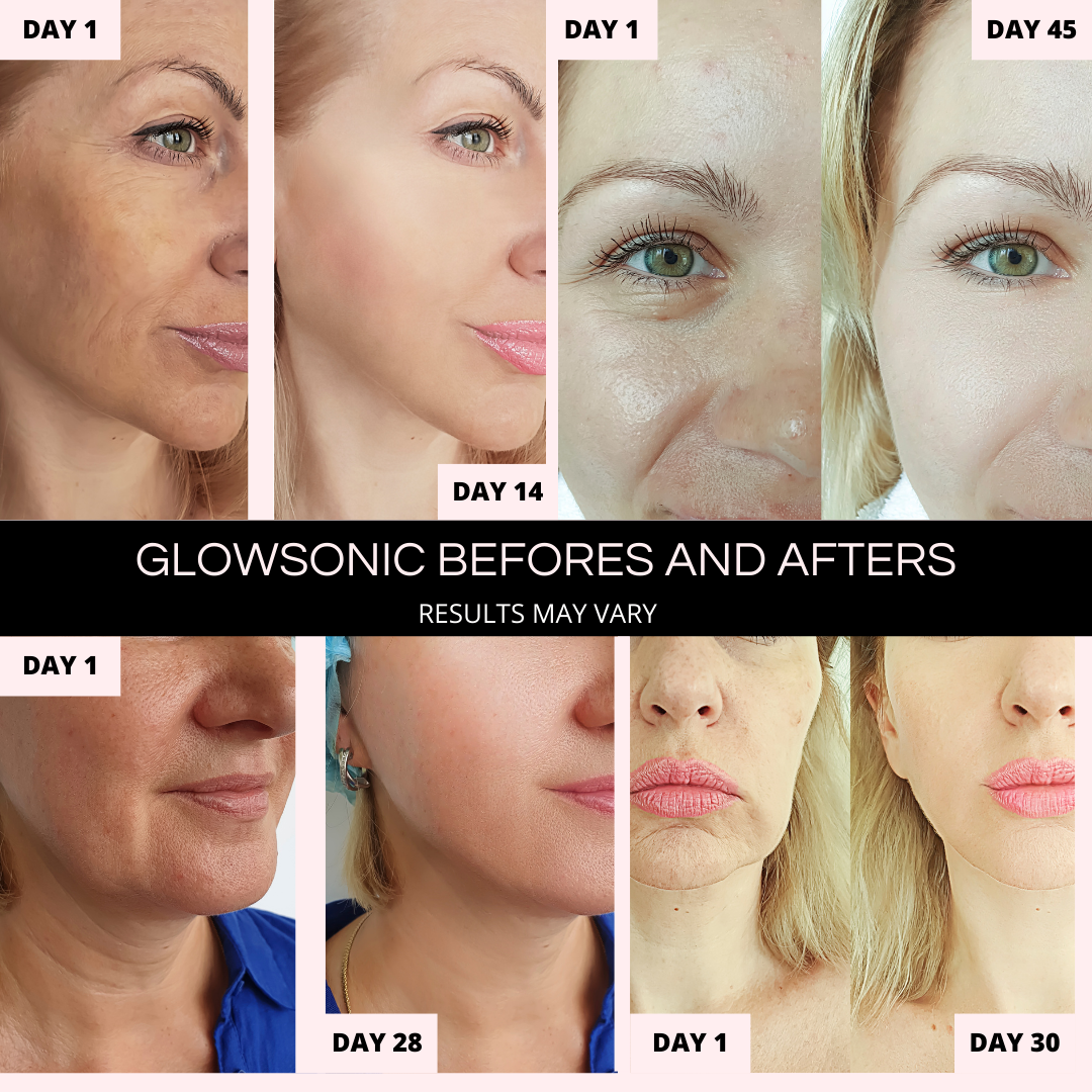 4-in-1 Skincare with Glowsonic