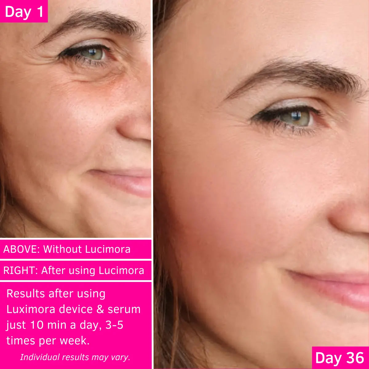 6-in-1 Face & Neck Lift Pro