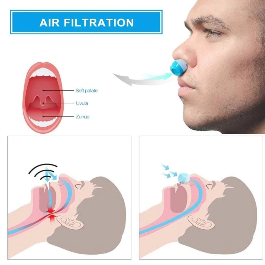 AlaskaTag - Airing: The first hoseless, maskless, micro-CPAP Anti Snoring