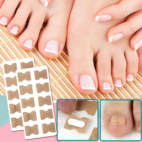 tightes - Correction patches for beautiful and healthy nails