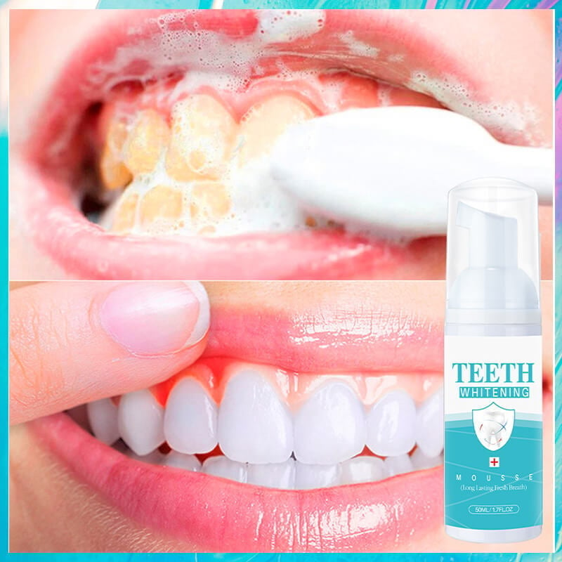 Last Day - SAVE 49% OFF - Teeth Whitening Mousse (BUY 2 GET 1 FREE)