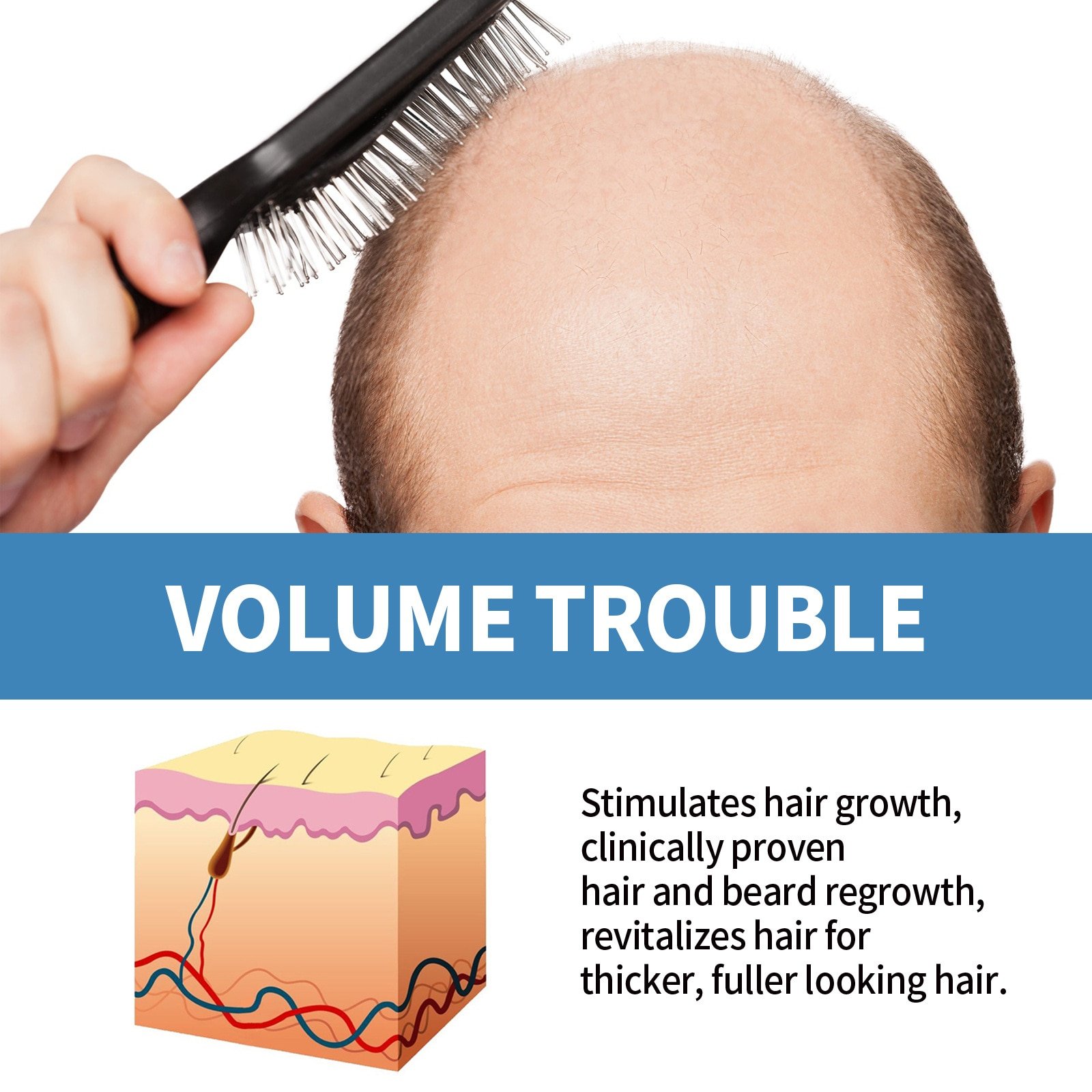 Oveallgo ScalpRevive Minoxidil Growth Roller