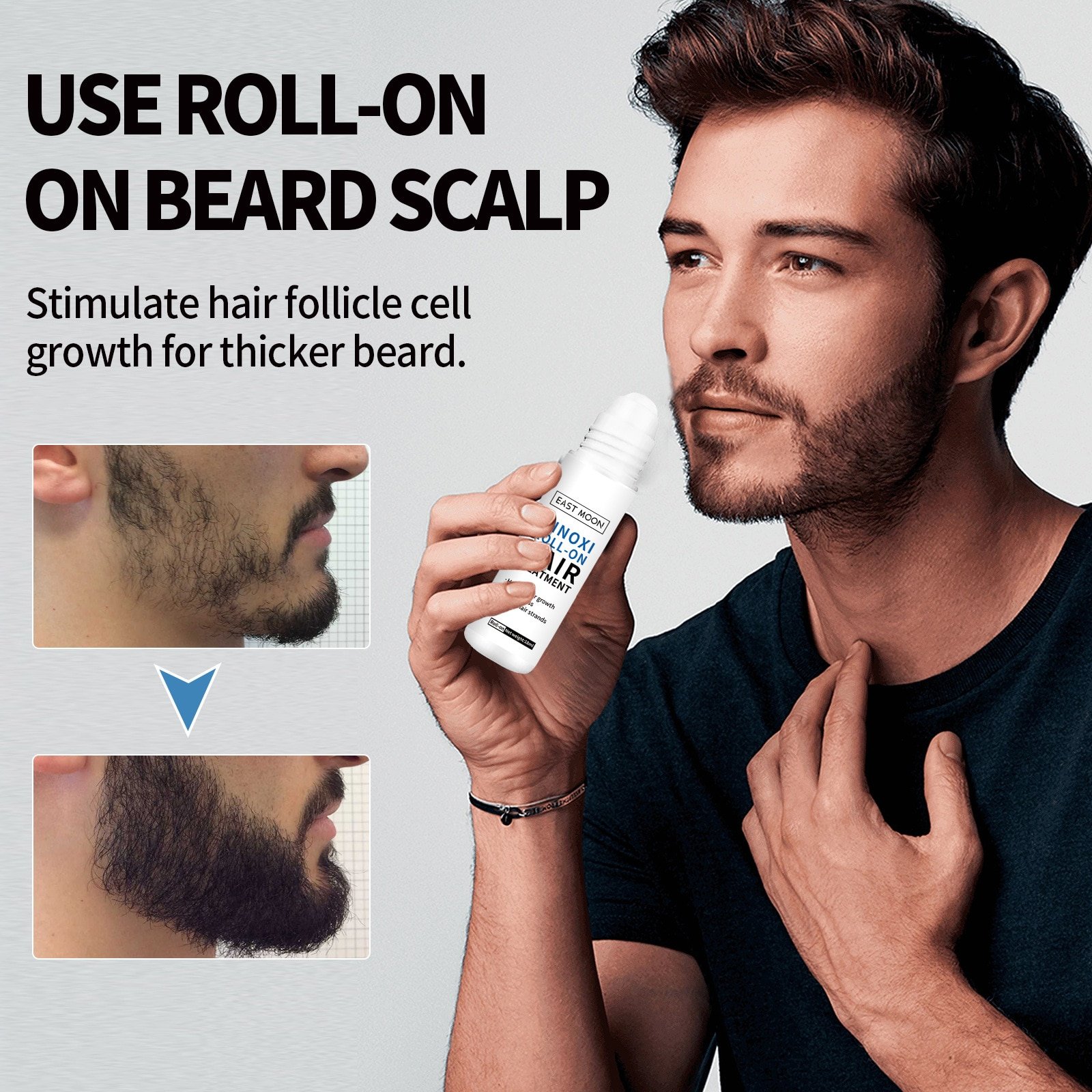 Oveallgo ScalpRevive Minoxidil Growth Roller