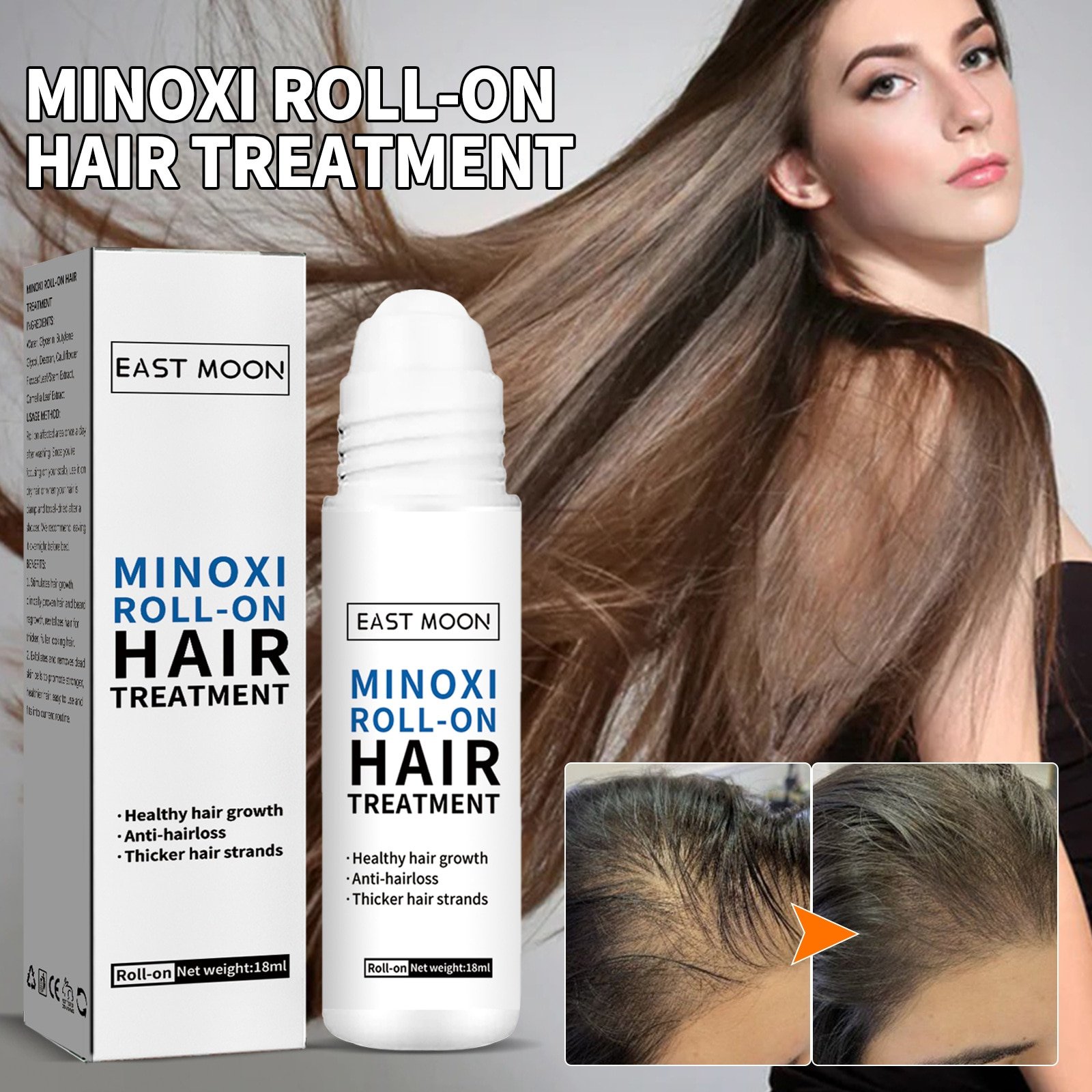 Oveallgo ScalpRevive Minoxidil Growth Roller