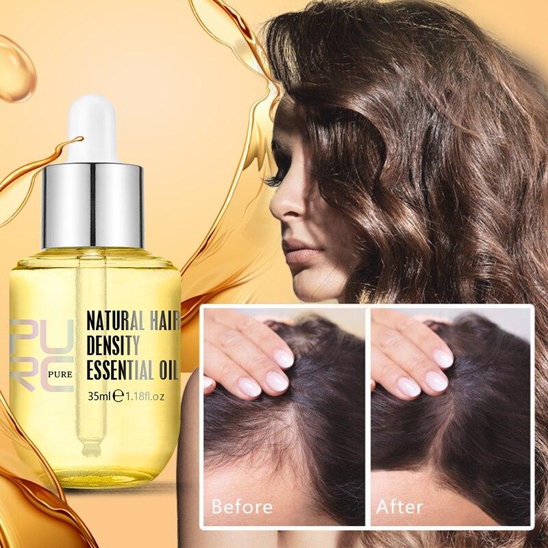 PURC Hair Growth Essential Oil - Reclaim Your Luscious Locks!