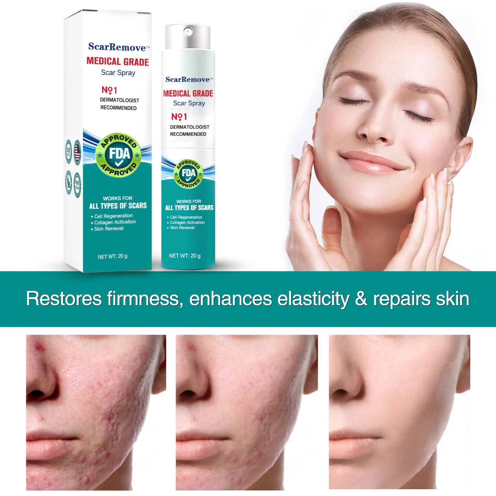 Scarremove Advanced Scar Spray For All Types Of Scars Especially Acne Scars Surgical Scars