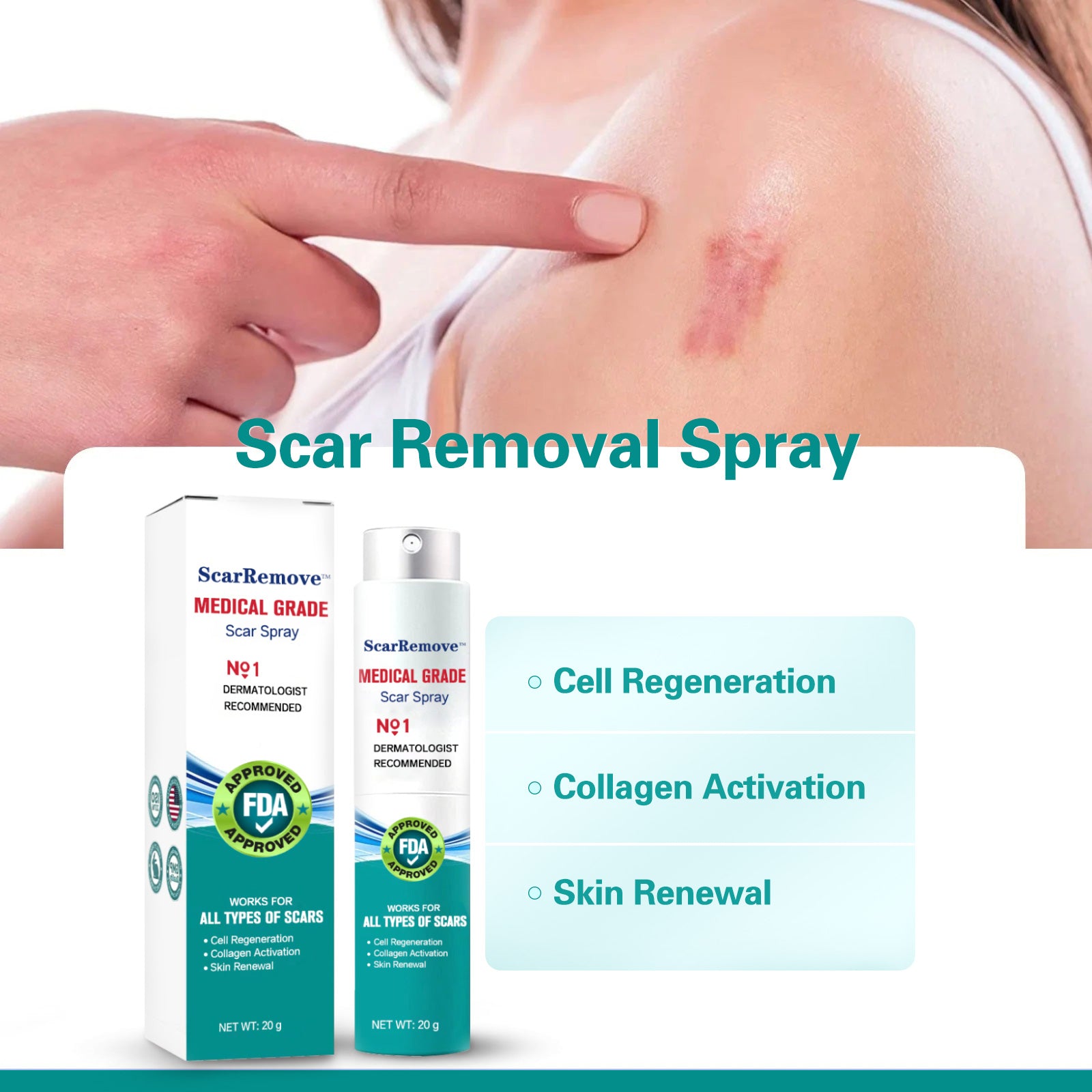 ScarRemove Advanced Scar Spray For All Types of Scars - Especially Acne Scars, Surgical Scars and Stretch Marks