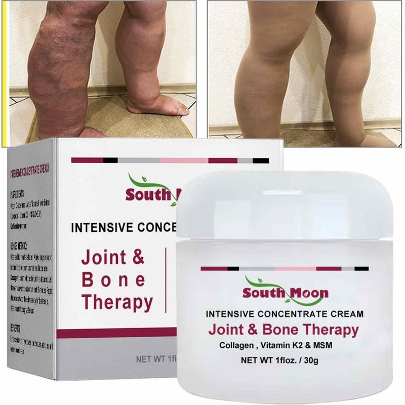 SouthMoon Joint & Bone Therapy Cream - Effective Bone Correction