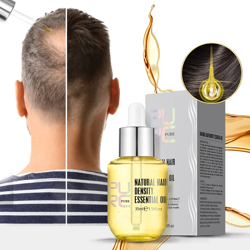 Hair Growth Essential Oil - Reclaim Your Luscious Locks