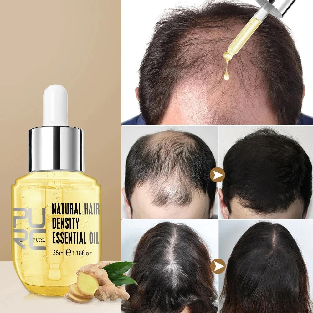 Hair Growth Essential Oil - Reclaim Your Luscious Locks