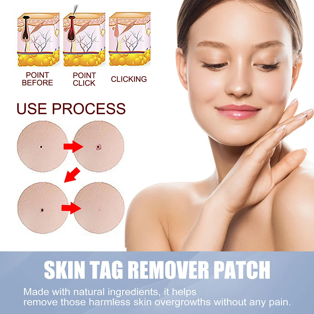 LAST DAY - 70% OFF - Skin Tag Remover Patch