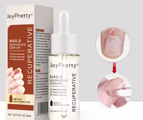 (Last Day 85% OFF) 7 Days Nail Growth and Strengthening Serum