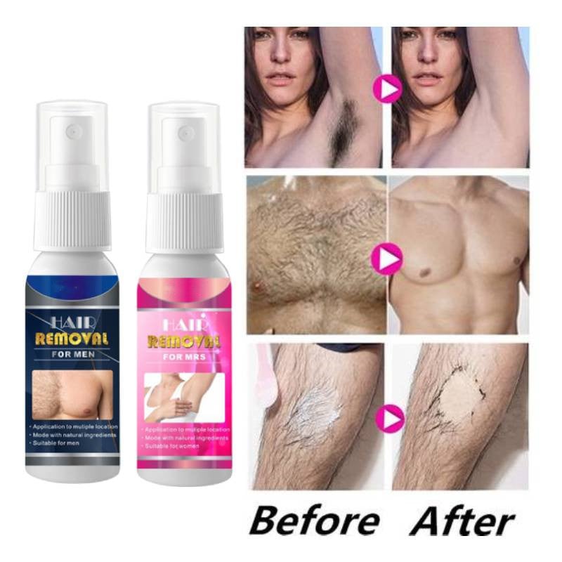 Natural Permarent Hair Removal Spray (Men And Women)