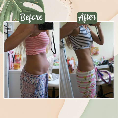 Perfect Detox Slimming Patch(Limited Time Discount Last Day)