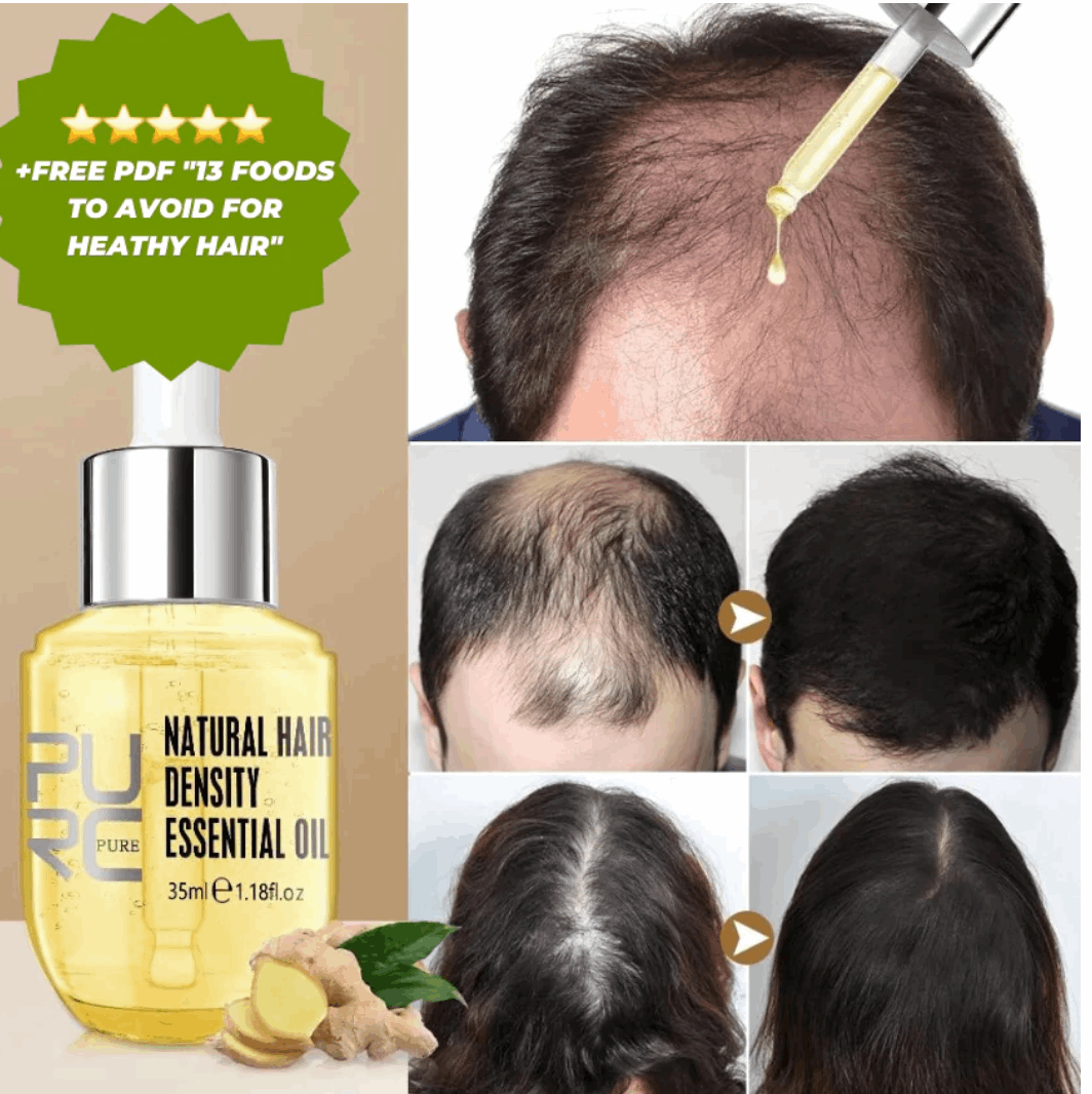 PURC Hair Regrowth Treatment For Anti Hair Loss & Hair Growth