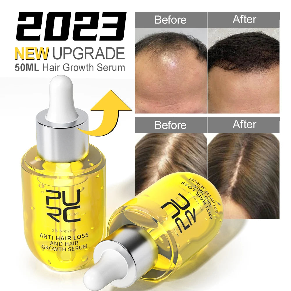 PURC Hair Regrowth Treatment For Anti Hair Loss & Hair Growth