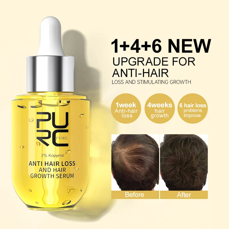 PURC Hair Regrowth Treatment For Anti Hair Loss & Hair Growth