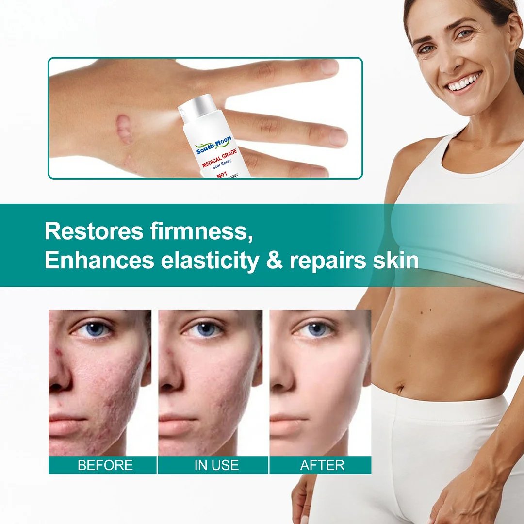 ADVANCED SCAR SPRAY FOR ALL TYPES OF SCARS - FOR EXAMPLE ACNE SCARS, SURGICAL SCARS AND STRETCH MARKS